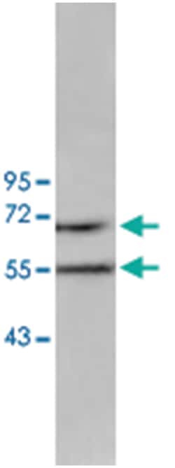 ACVRL1 Rabbit anti-Human, Polyclonal Antibody, Abnova 100&mu;g; Unlabeled:Antibodies,
