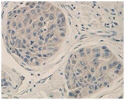 ACVRL1 Rabbit anti-Human, Polyclonal Antibody, Abnova 100&mu;g; Unlabeled:Antibodies,