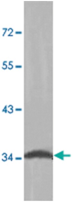 HOXA1, Rabbit, Polyclonal Antibody, Abnova 100&mu;g; Unlabeled:Antibodies,
