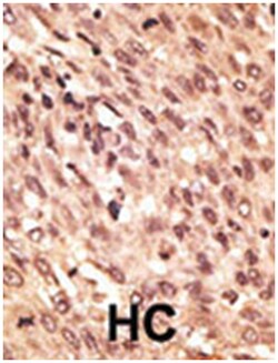 LRP5 Rabbit anti-Human, Mouse, Polyclonal Antibody, Abnova 400 &mu;L | Buy Online | Abnova | Fisher Scientific
