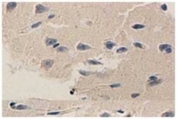 APP Rabbit anti-Human, Mouse, Rat, Polyclonal Antibody, Abnova 100 &mu;g | Buy Online | Abnova Corporation | Fisher Scientific