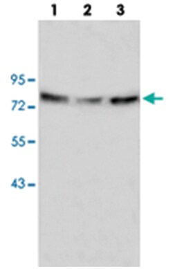 ANXA6 Rabbit anti-Human, Polyclonal Antibody, Abnova 100 &mu;g | Buy Online | Abnova Corporation | Fisher Scientific