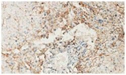ANXA6 Rabbit anti-Human, Polyclonal Antibody, Abnova 100 &mu;g | Buy Online | Abnova Corporation | Fisher Scientific