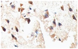 CTNNA2 Rabbit anti-Human, Polyclonal Antibody, Abnova 100 &mu;g | Buy Online | Abnova Corporation | Fisher Scientific