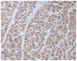 ADRA1B Rabbit anti-Human, Polyclonal Antibody, Abnova 100 &mu;g | Buy Online | Abnova Corporation | Fisher Scientific