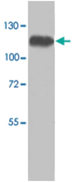 ADD1 Rabbit anti-Human, Polyclonal Antibody, Abnova 100&mu;g; Unlabeled:Antibodies,