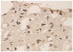 ADD1 Rabbit anti-Human, Polyclonal Antibody, Abnova 100&mu;g; Unlabeled:Antibodies,