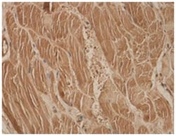 CAPG Rabbit anti-Human, Mouse, Rat, Polyclonal Antibody, Abnova 100 &mu;g | Buy Online | Abnova Corporation | Fisher Scientific