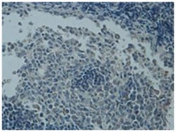 NOTCH1 Rabbit anti-Human, Mouse, Rat, Polyclonal Antibody, Abnova 100 &mu;g | Buy Online | Abnova Corporation | Fisher Scientific