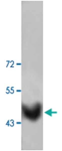 ACTA2 Rabbit anti-Human, Mouse, Rat, Polyclonal Antibody, Abnova 100 &mu;g | Buy Online | Abnova Corporation | Fisher Scientific