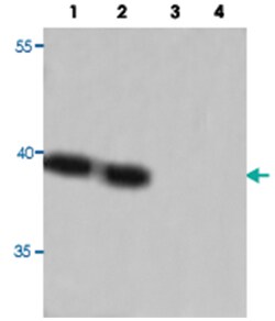 CREB3L4, Rabbit, Polyclonal Antibody, Abnova 100&mu;g; Unlabeled:Antibodies,
