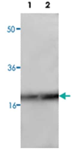 AURKAIP1, Rabbit, Polyclonal Antibody, Abnova 100 &mu;g | Buy Online | Abnova Corporation | Fisher Scientific