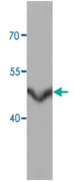 AKAP7, Rabbit, Polyclonal Antibody, Abnova 100&mu;g; Unlabeled:Antibodies,