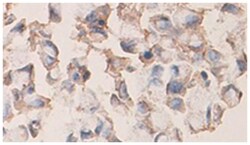 PRKAB1 Rabbit anti-Human, Polyclonal Antibody, Abnova 100 &mu;g | Buy Online | Abnova Corporation | Fisher Scientific