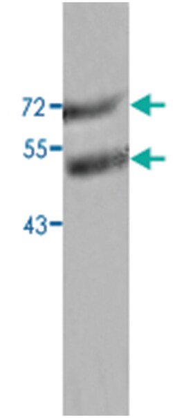 ANGPTL3 Rabbit anti-Human, Polyclonal Antibody, Abnova 100 &mu;g | Buy Online | Abnova | Fisher Scientific