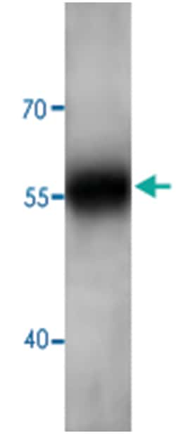 AKT3 Rabbit anti-Human, Mouse, Rat, Polyclonal Antibody, Abnova 100 &mu;g | Buy Online | Abnova Corporation | Fisher Scientific