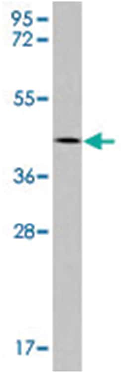 SIRT6 Rabbit anti-Human, Mouse, Polyclonal Antibody, Abnova 400 &mu;L | Buy Online | Abnova Corporation | Fisher Scientific