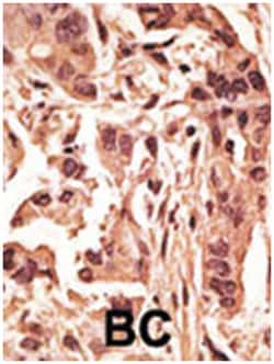 SIRT6 Rabbit anti-Human, Mouse, Polyclonal Antibody, Abnova 400 &mu;L | Buy Online | Abnova Corporation | Fisher Scientific