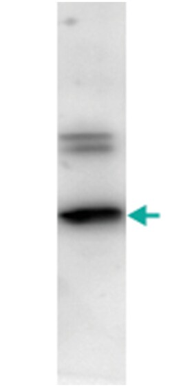 Tobacco Etch Virus Protease, Rabbit, Polyclonal Antibody, Abnova 100 &mu;g | Buy Online | Abnova Corporation | Fisher Scientific