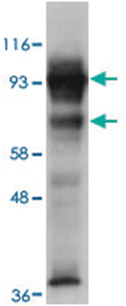 ODF2 Rabbit anti-Human, Polyclonal Antibody, Abnova 100 &mu;g | Buy Online | Abnova Corporation | Fisher Scientific
