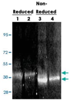 SERPINB14 (Ovalbumin), Rabbit, FITC, Polyclonal Antibody, Abnova 100&mu;g;