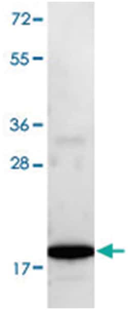 IL7, Rabbit, Biotin, Polyclonal Antibody, Abnova 100 &mu;g | Buy Online | Abnova Corporation | Fisher Scientific