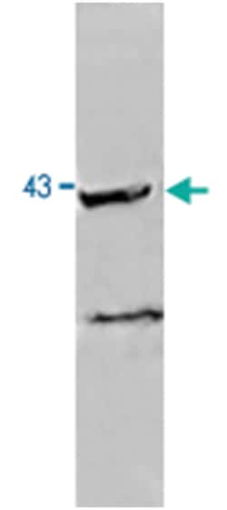NEU2, Rabbit, Polyclonal Antibody, Abnova 100 &mu;g | Buy Online | Abnova Corporation | Fisher Scientific