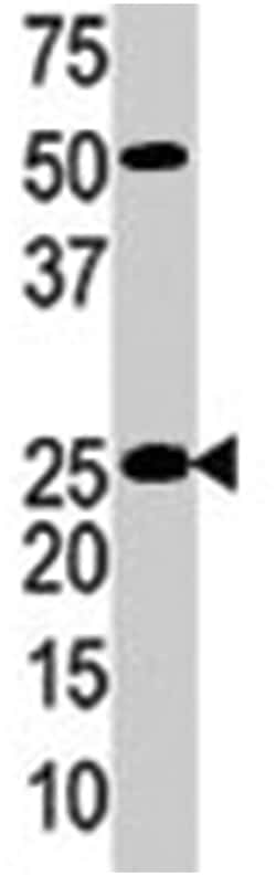 KLK4 Rabbit anti-Human, Polyclonal Antibody, Abnova 400&mu;L; Unlabeled:Antibodies,