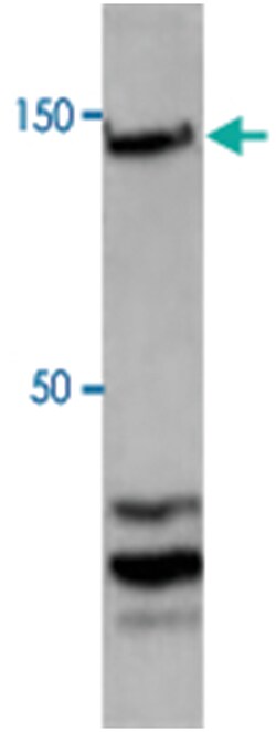 CTCF, Rabbit, Polyclonal Antibody, Abnova 100&mu;g; Unlabeled:Antibodies,