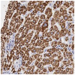 OTC Rabbit anti-Human, Polyclonal Antibody, Abnova 100&mu;L; Unlabeled:Antibodies,