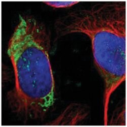OTC Rabbit anti-Human, Polyclonal Antibody, Abnova 100&mu;L; Unlabeled:Antibodies,