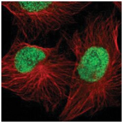 DACH2, Rabbit, Polyclonal Antibody, Abnova 100&mu;L; Unlabeled:Antibodies,