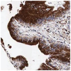 CKAP4 Rabbit anti-Human, Polyclonal Antibody, Abnova 100 &mu;L | Buy Online | Abnova Corporation | Fisher Scientific
