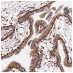 CXorf15 Rabbit anti-Human, Polyclonal Antibody, Abnova 100 &mu;L | Buy Online | Abnova Corporation | Fisher Scientific