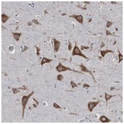 CTAGE5 Rabbit anti-Human, Polyclonal Antibody, Abnova 100 &mu;L | Buy Online | Abnova Corporation | Fisher Scientific