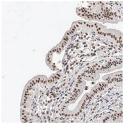 AUTS2, Rabbit, Polyclonal Antibody, Abnova 100&mu;L; Unlabeled:Antibodies,