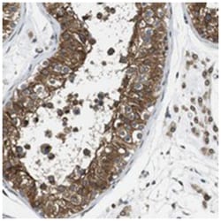 TXNDC13 Rabbit anti-Human, Polyclonal Antibody, Abnova 100&mu;L; Unlabeled:Antibodies,