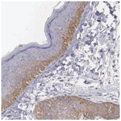 NREP, Rabbit, Polyclonal Antibody, Abnova 100 &mu;L | Buy Online | Abnova | Fisher Scientific