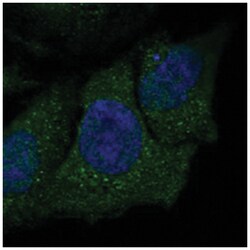NREP, Rabbit, Polyclonal Antibody, Abnova 100 &mu;L | Buy Online | Abnova | Fisher Scientific