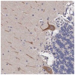 ABHD4, Rabbit, Polyclonal Antibody, Abnova 100&mu;L; Unlabeled:Antibodies,