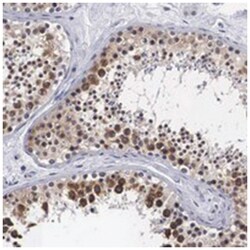 OTX2, Rabbit, Polyclonal Antibody, Abnova 100&mu;L; Unlabeled:Antibodies,