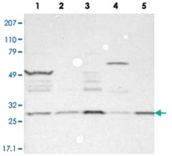 FAM109B, Rabbit, Polyclonal Antibody, Abnova 100 &mu;L | Buy Online | Abnova Corporation | Fisher Scientific