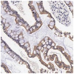 FAM109B, Rabbit, Polyclonal Antibody, Abnova 100 &mu;L | Buy Online | Abnova Corporation | Fisher Scientific