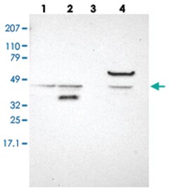 ACOT4 Rabbit anti-Human, Polyclonal Antibody, Abnova 100&mu;L; Unlabeled:Antibodies,