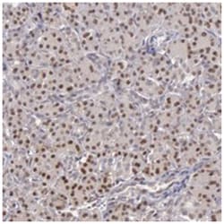 ADRBK2 Rabbit anti-Human, Polyclonal Antibody, Abnova 100&mu;L; Unlabeled:Antibodies,