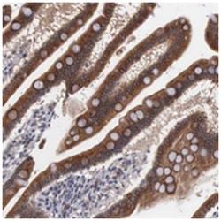 AMN, Rabbit, Polyclonal Antibody, Abnova 100&mu;L; Unlabeled:Antibodies,