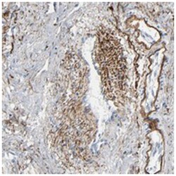 FBLN5 Rabbit anti-Human, Polyclonal Antibody, Abnova 100&mu;L; Unlabeled:Antibodies,