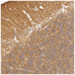 RALGAPA1, Rabbit, Polyclonal Antibody, Abnova 100&mu;L; Unlabeled:Antibodies,