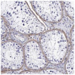FBLN5 Rabbit anti-Human, Polyclonal Antibody, Abnova 100 &mu;L | Buy Online | Abnova Corporation | Fisher Scientific