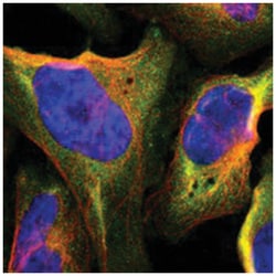 FBLN5 Rabbit anti-Human, Polyclonal Antibody, Abnova 100 &mu;L | Buy Online | Abnova Corporation | Fisher Scientific